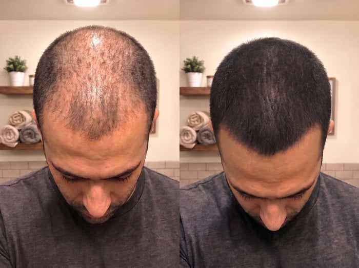 Antes y después de un cliente