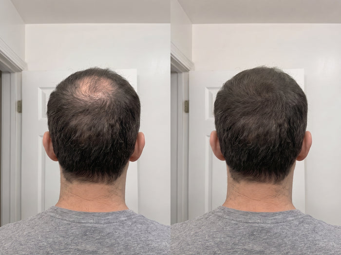 Antes y después de un cliente
