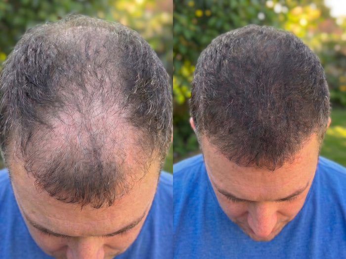 Antes y después de un cliente