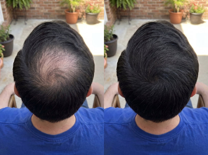 Antes y después de un cliente